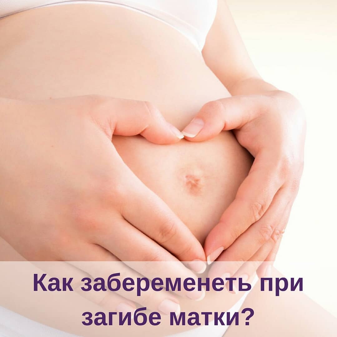 Фото:матка в загибе как забеременеть